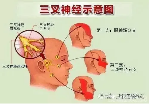 5f17f62d9bdd5.png image.png