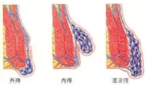 5f34a8885a2ac.png image.png