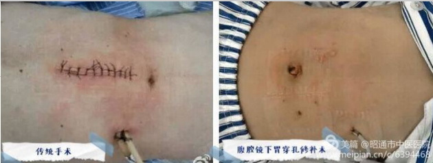 5f35f3615d5a0.png image.png