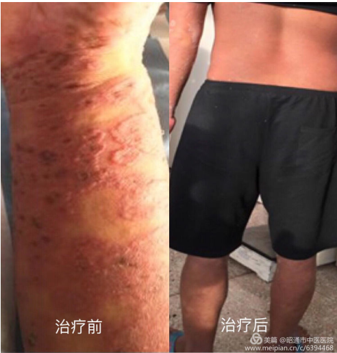 5f3ba75ef2a0a.png image.png