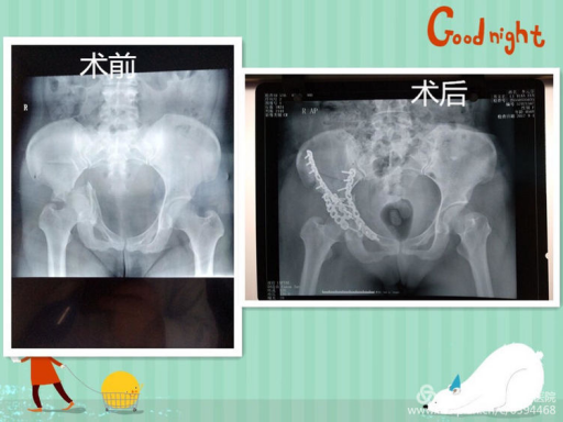 5f3c9b77b5b9b.png image.png