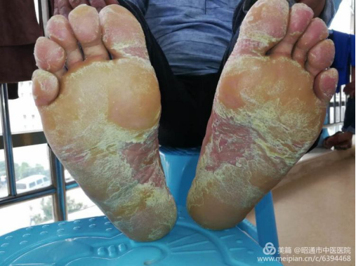 5f43846e01120.png image.png