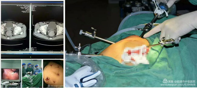 5f44758565bde.png image.png