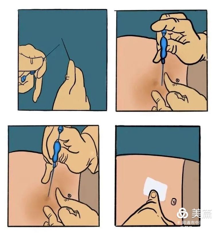 1.jpeg