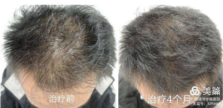 6087823cc2c98.jpeg 1.jpeg