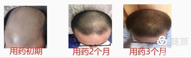 6087824fc2634.jpeg 3.jpeg