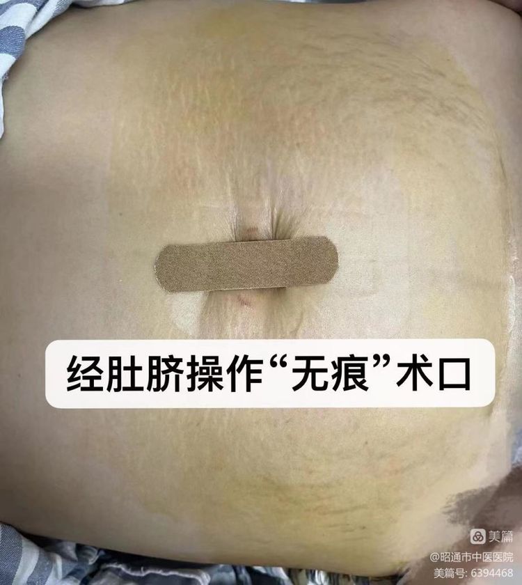 62d7cb2b12795.jpg 微信图片_20220720172937.jpg