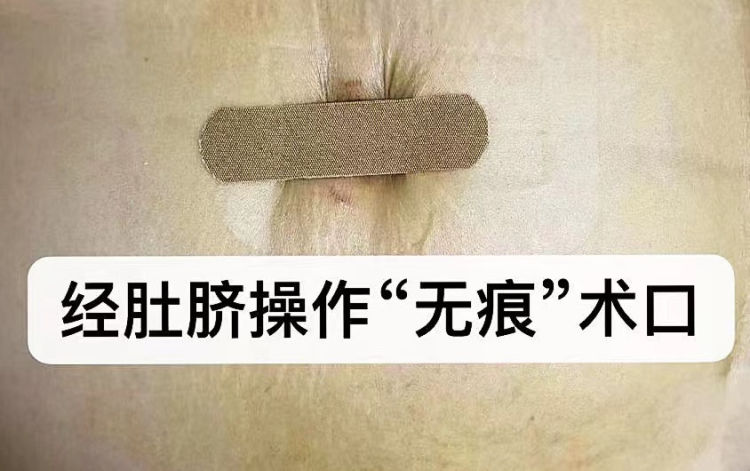 65a8d7273e35a.jpeg 6c1d5aad6b2243fc86b6cac4bf9a5882.jpeg