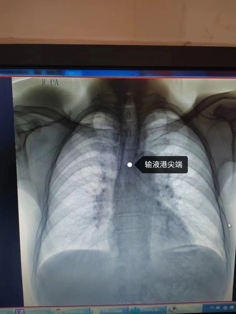 65d1c24e6a251.jpeg 6ea1bbdcf2d24a9a934a98495948449a.jpeg