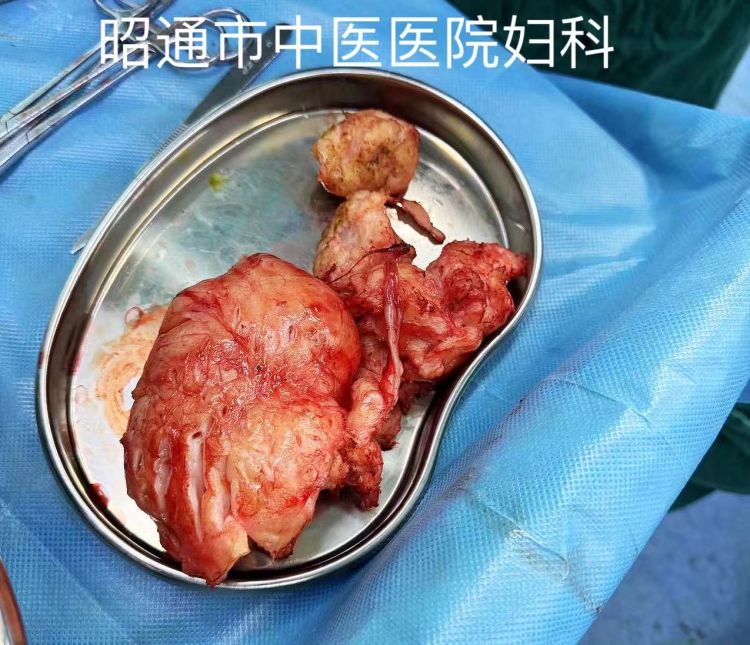 65d1c72884ddb.jpeg 305b14b128254b99bc2252d06a5711ca.jpeg