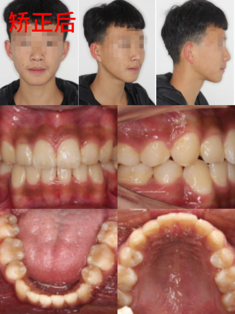 65f118f7dbabd.jpeg 5518feb28bc941e596fbd43b12ea7c1f.jpeg