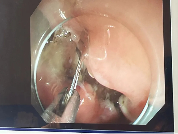 670e17c59aa08.png 1.png